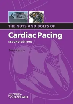 The Nuts and Bolts of Cardiac Pacing